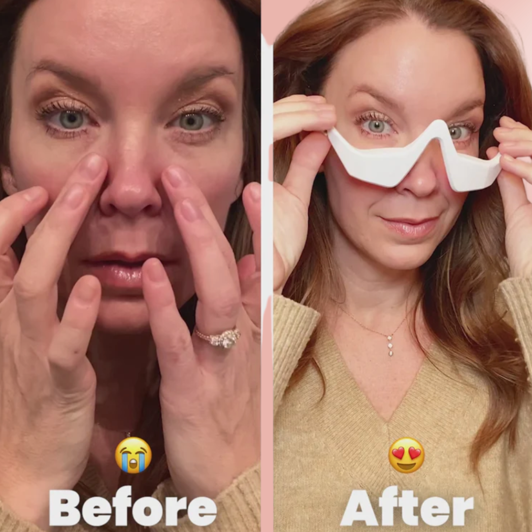 Under-Eye Red Light Massager