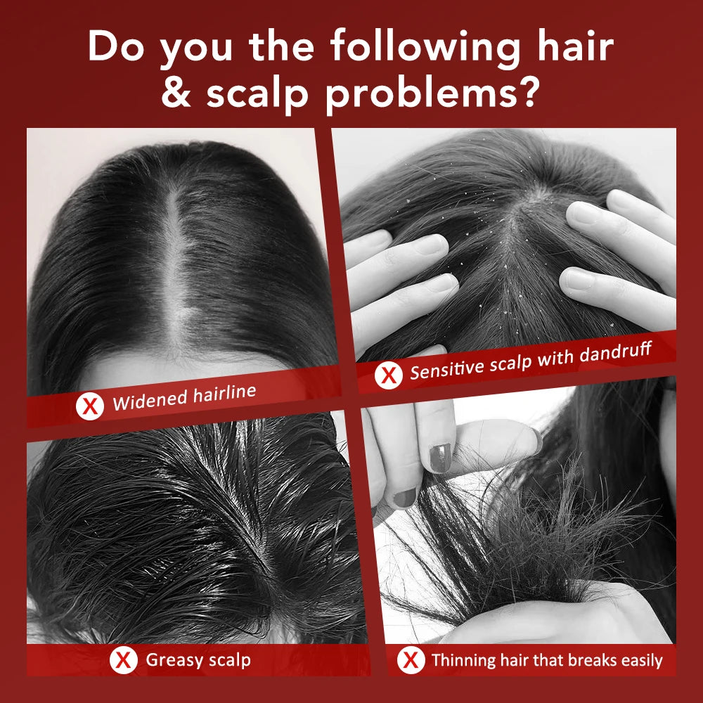 Hair Scalp Massager