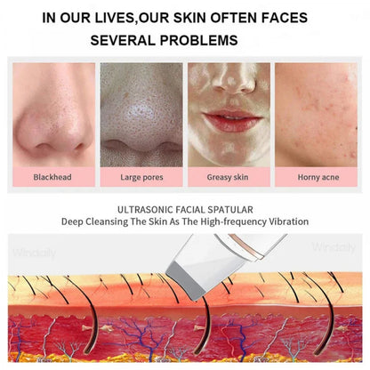 Ultrasonic Skin Scrubber