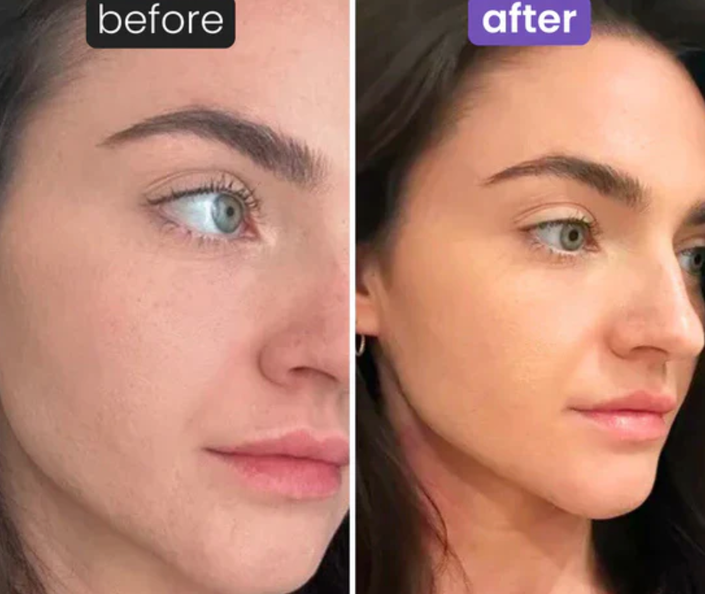 Beauty Roller