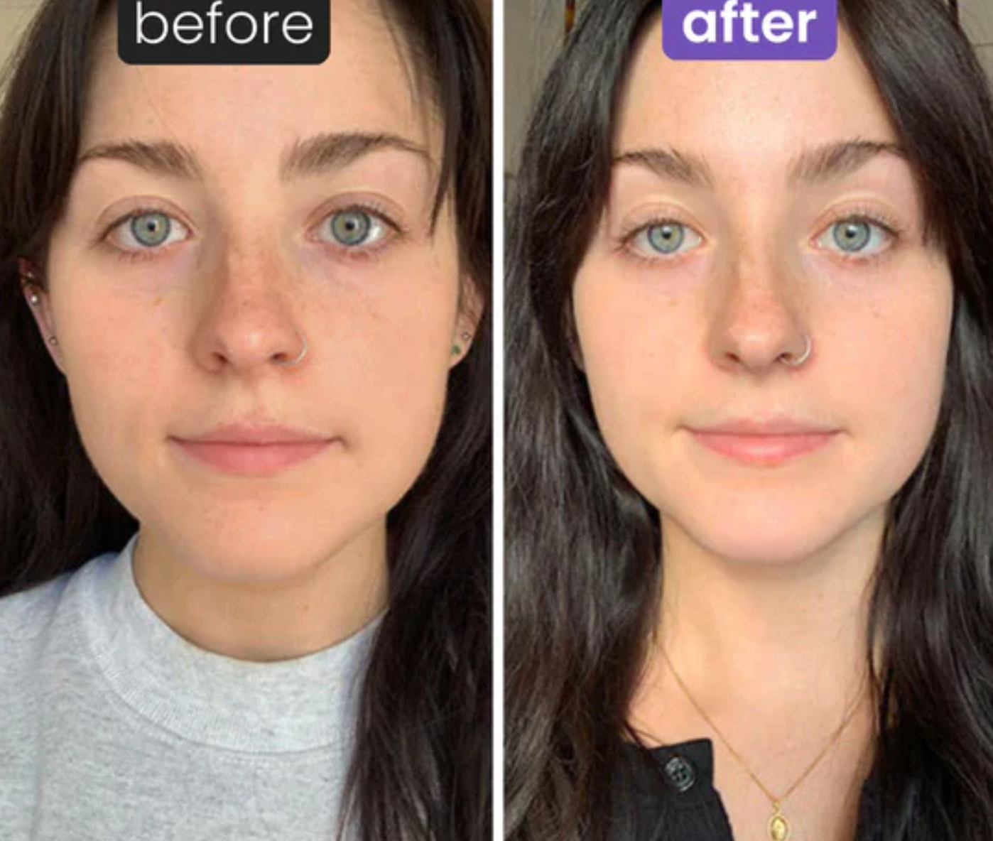 Beauty Roller