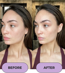 Beauty Roller