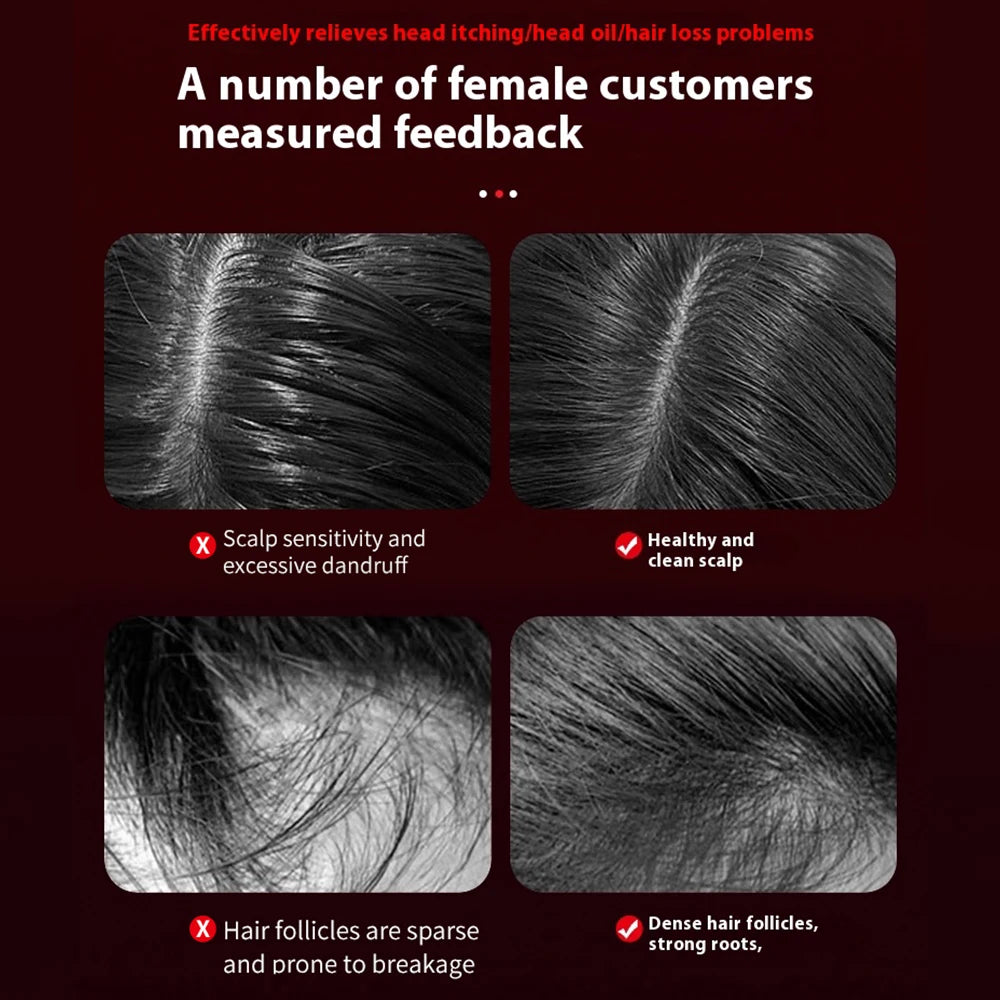 Hair Scalp Massager